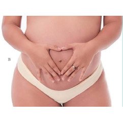 bikini maternidad  cod. 118